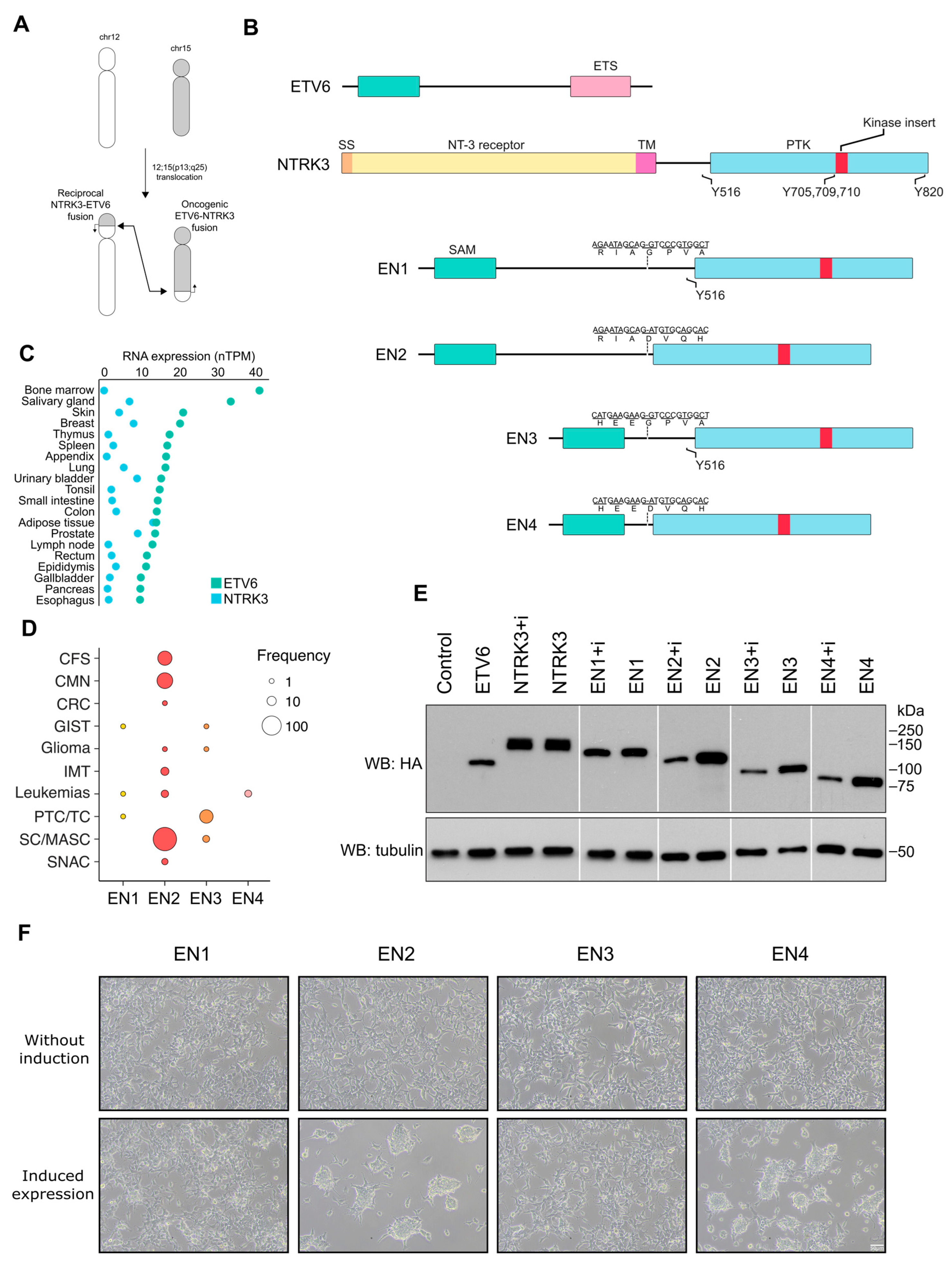 Cancers | Free Full-Text | The Impact of ETV6-NTRK3 Oncogenic Gene 