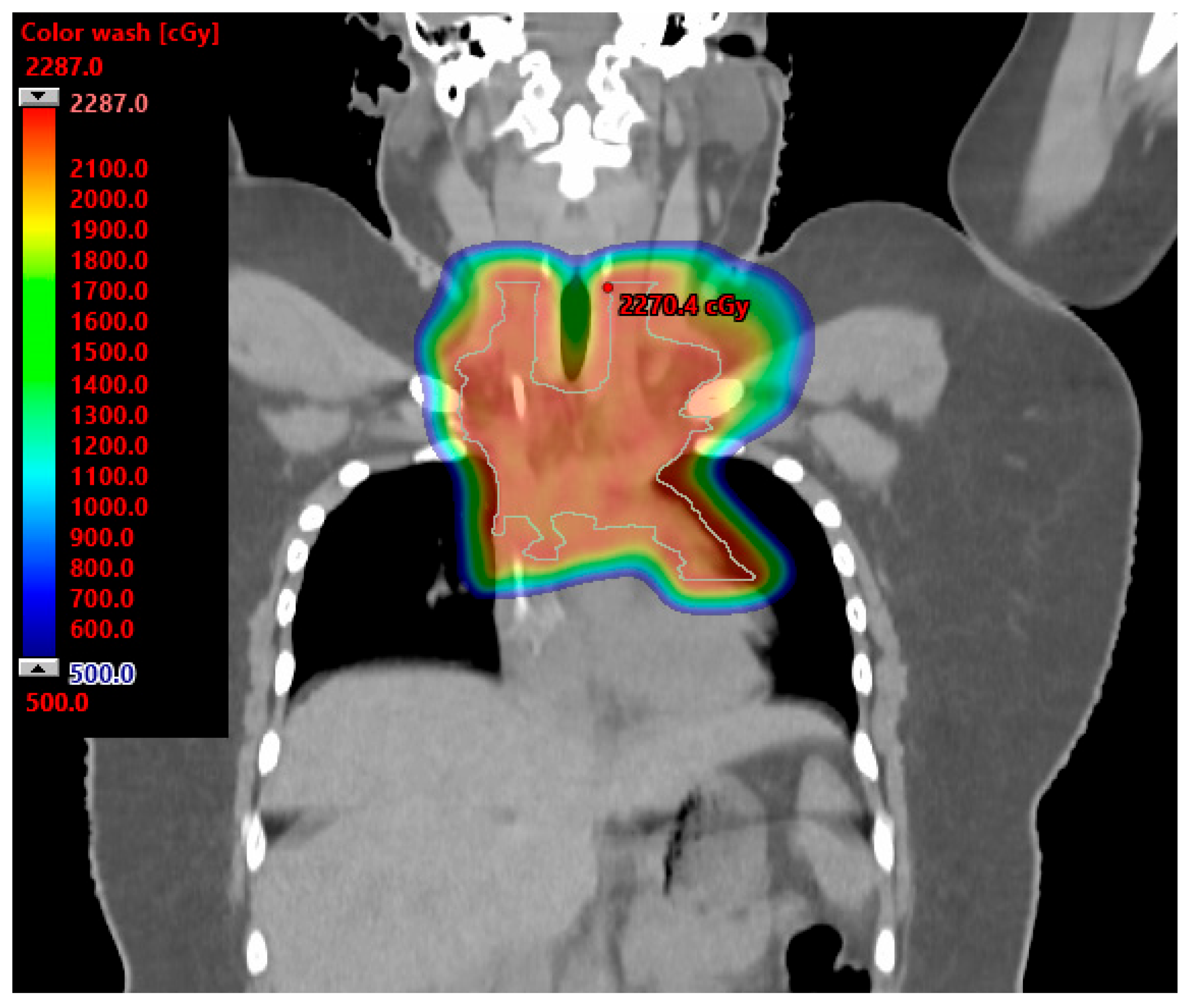 Cancers 15 04269 g003 Cancers 15 04269 g003