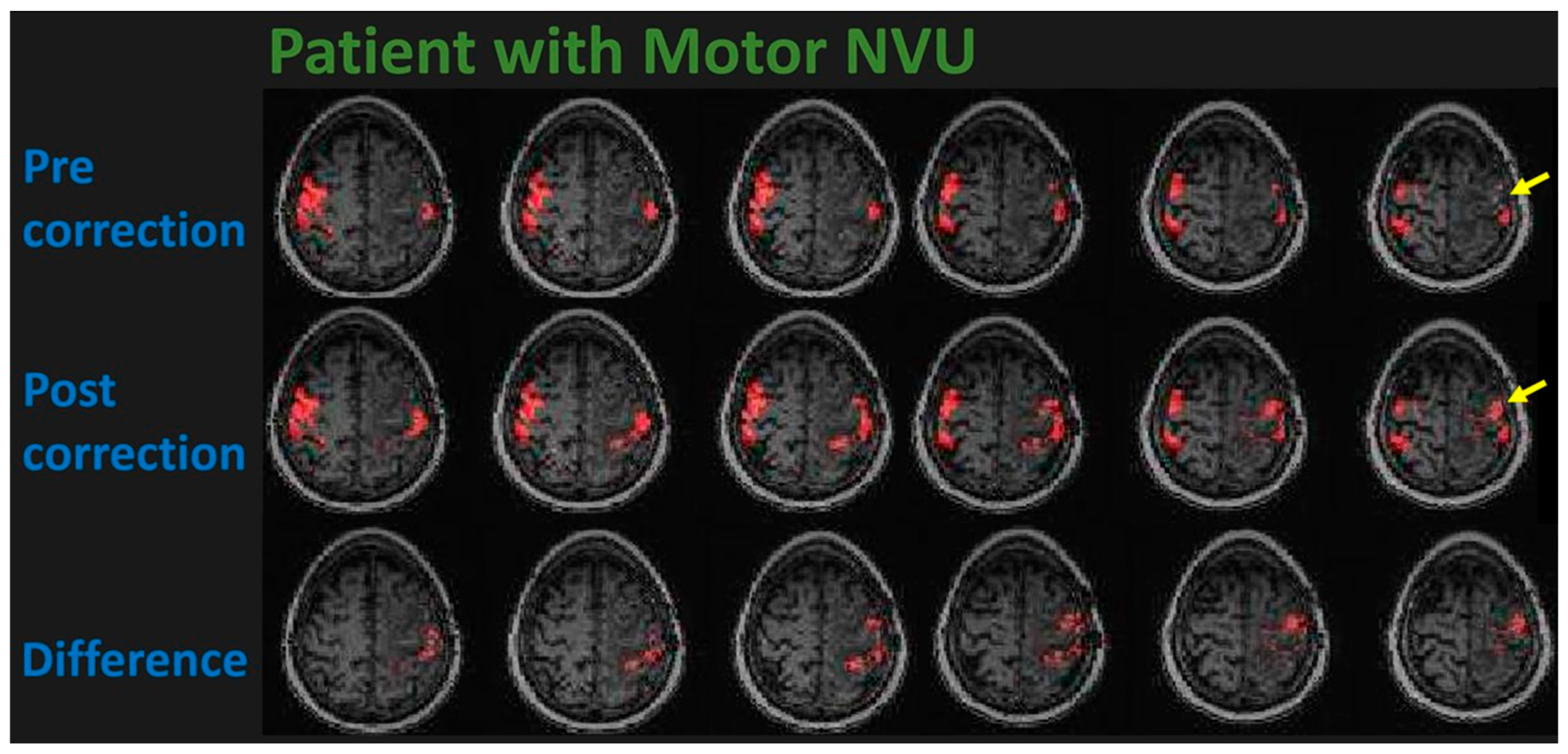 Cancers 15 04473 g004