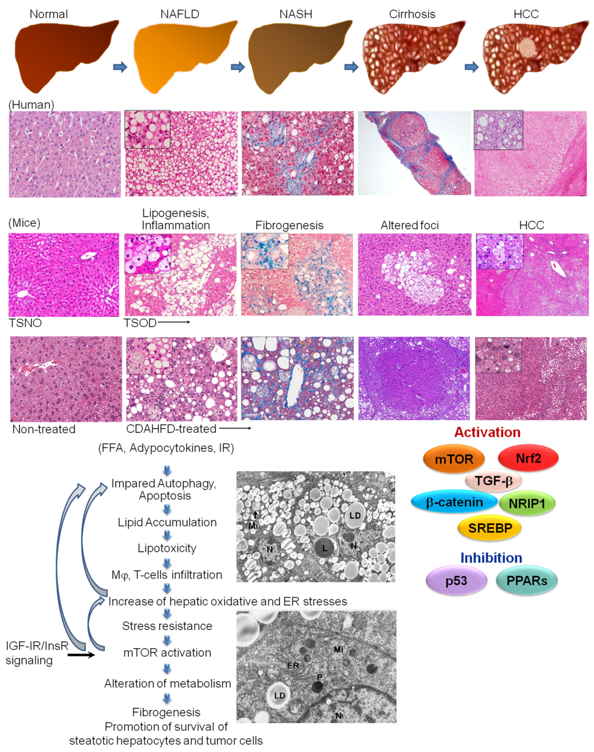 Monoacylglycerol Acyltransferase 2 (MGAT2) Inhibitors for the Treatment of  Metabolic Diseases and Nonalcoholic Steatohepatitis (NASH)