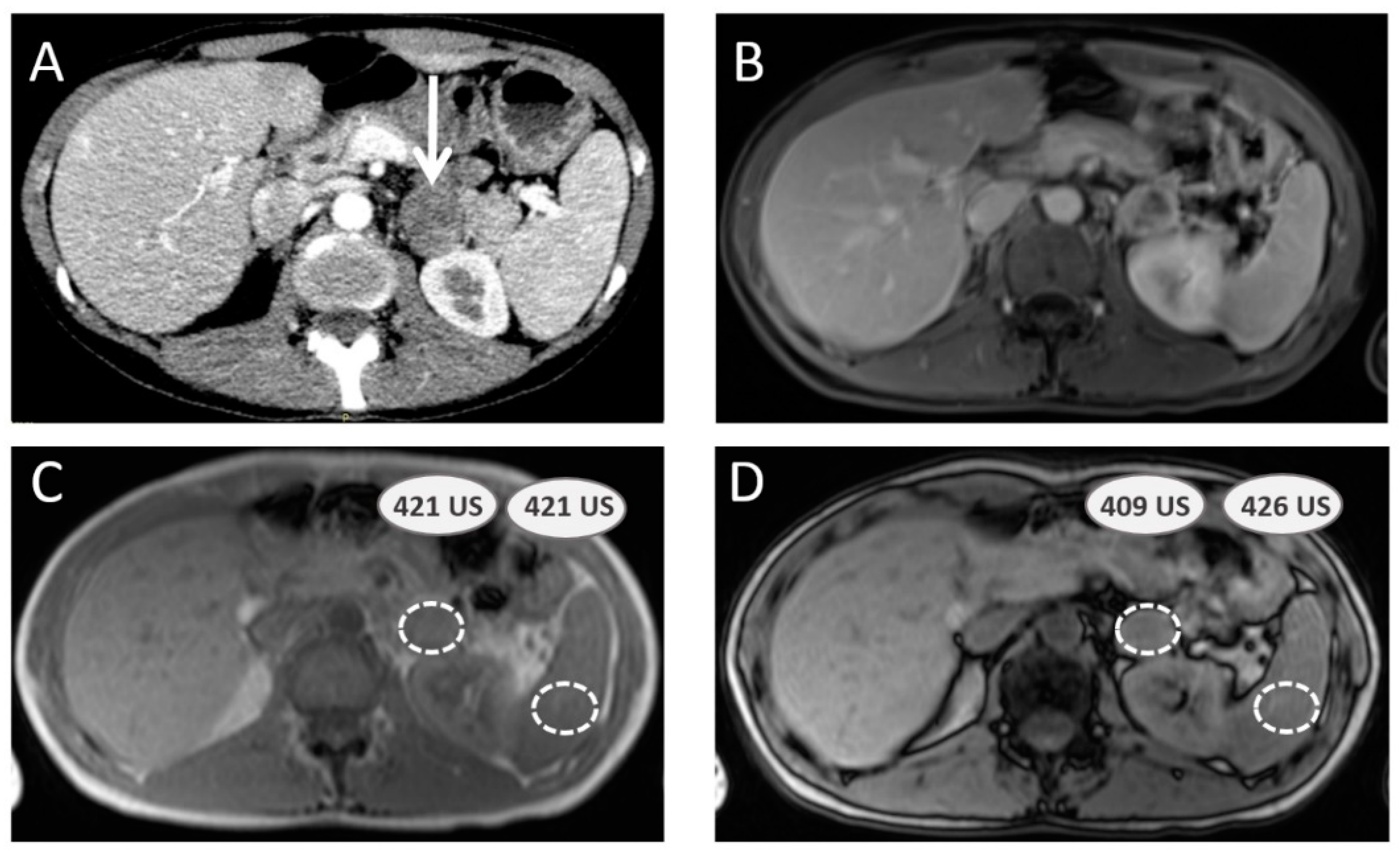 Cancers 15 04666 g002 Cancers 15 04666 g002