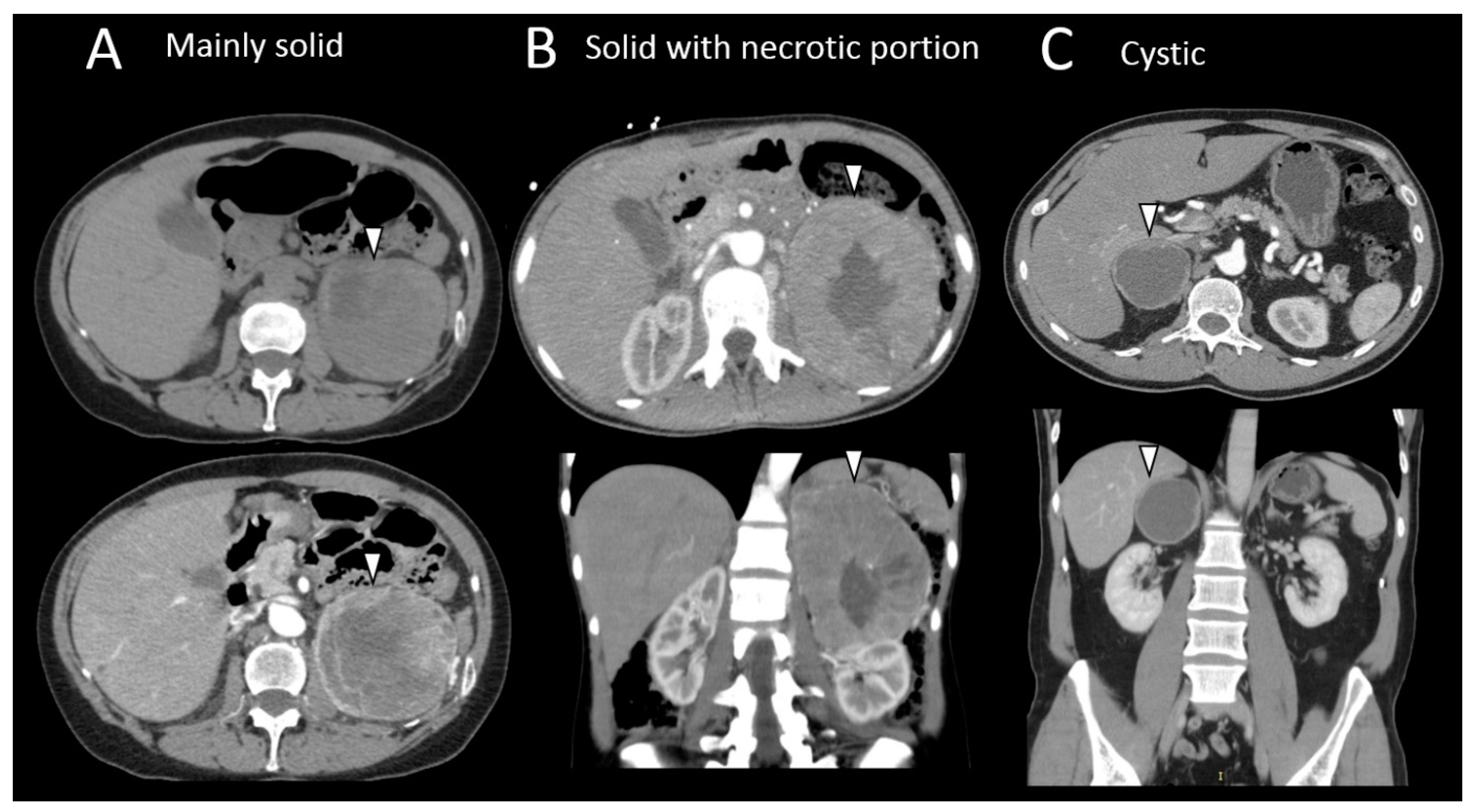 Cancers 15 04666 g003 Cancers 15 04666 g003
