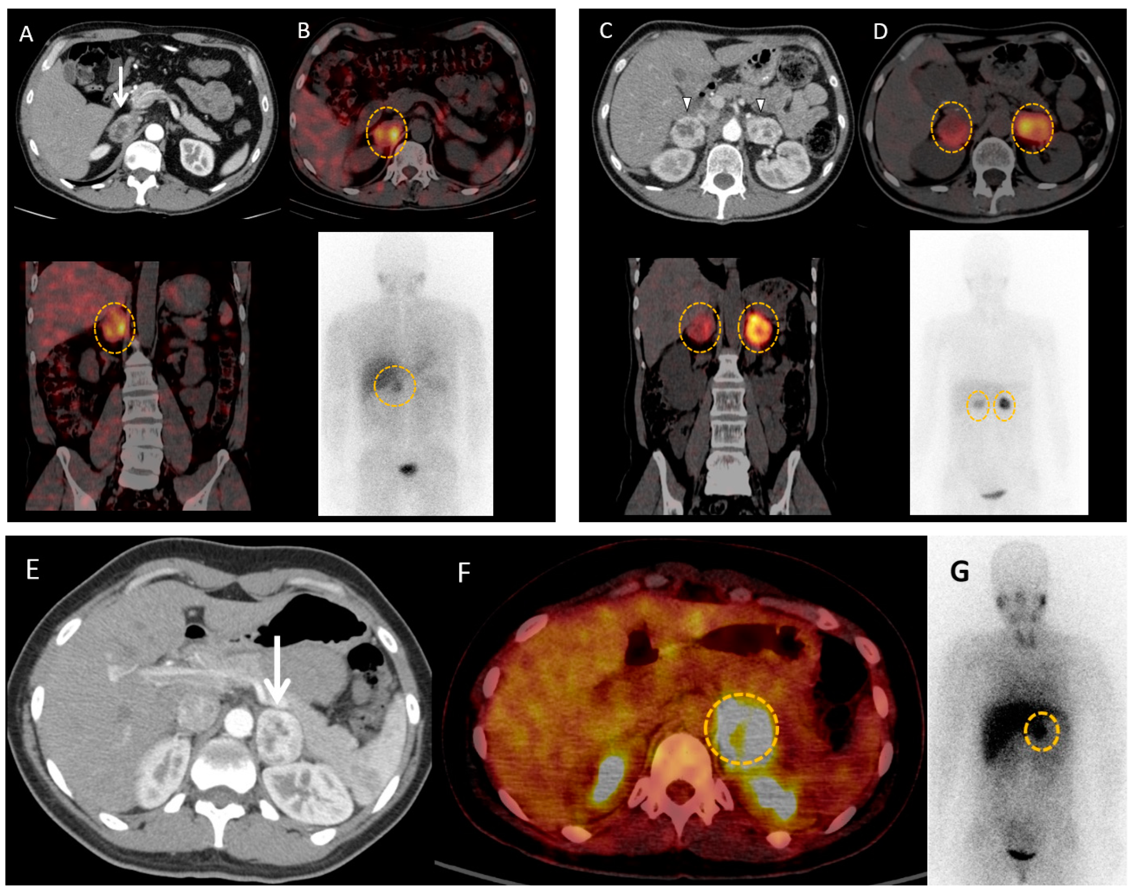 Cancers 15 04666 g004 Cancers 15 04666 g004