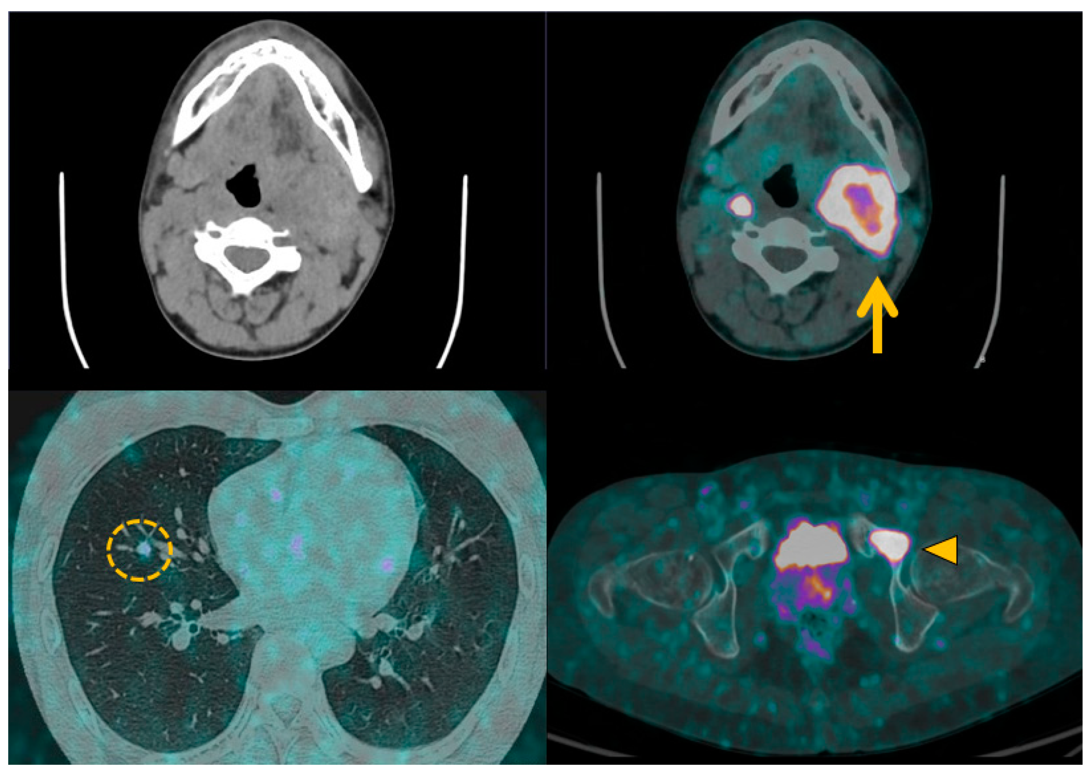 Cancers 15 04666 g006 Cancers 15 04666 g006