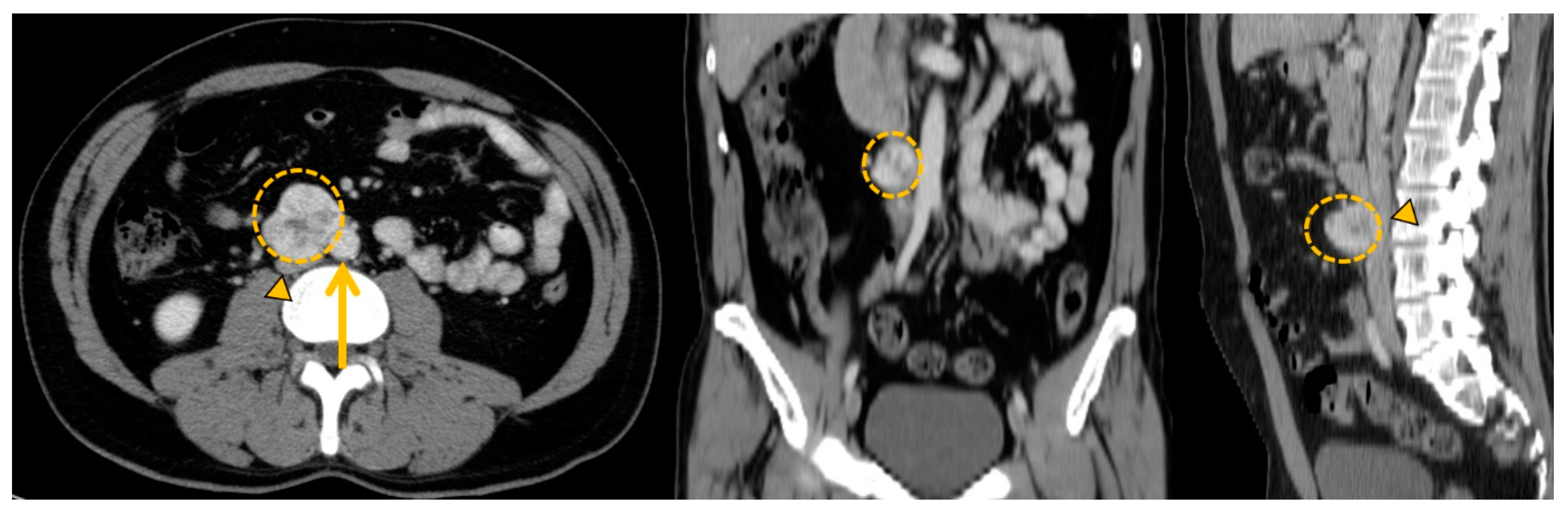 Cancers 15 04666 g008 Cancers 15 04666 g008