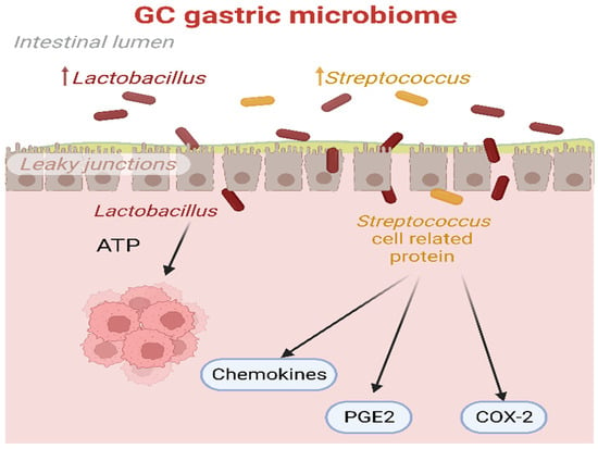 Cancers | Free Full-Text | Exploring the Microbiome in Gastric 