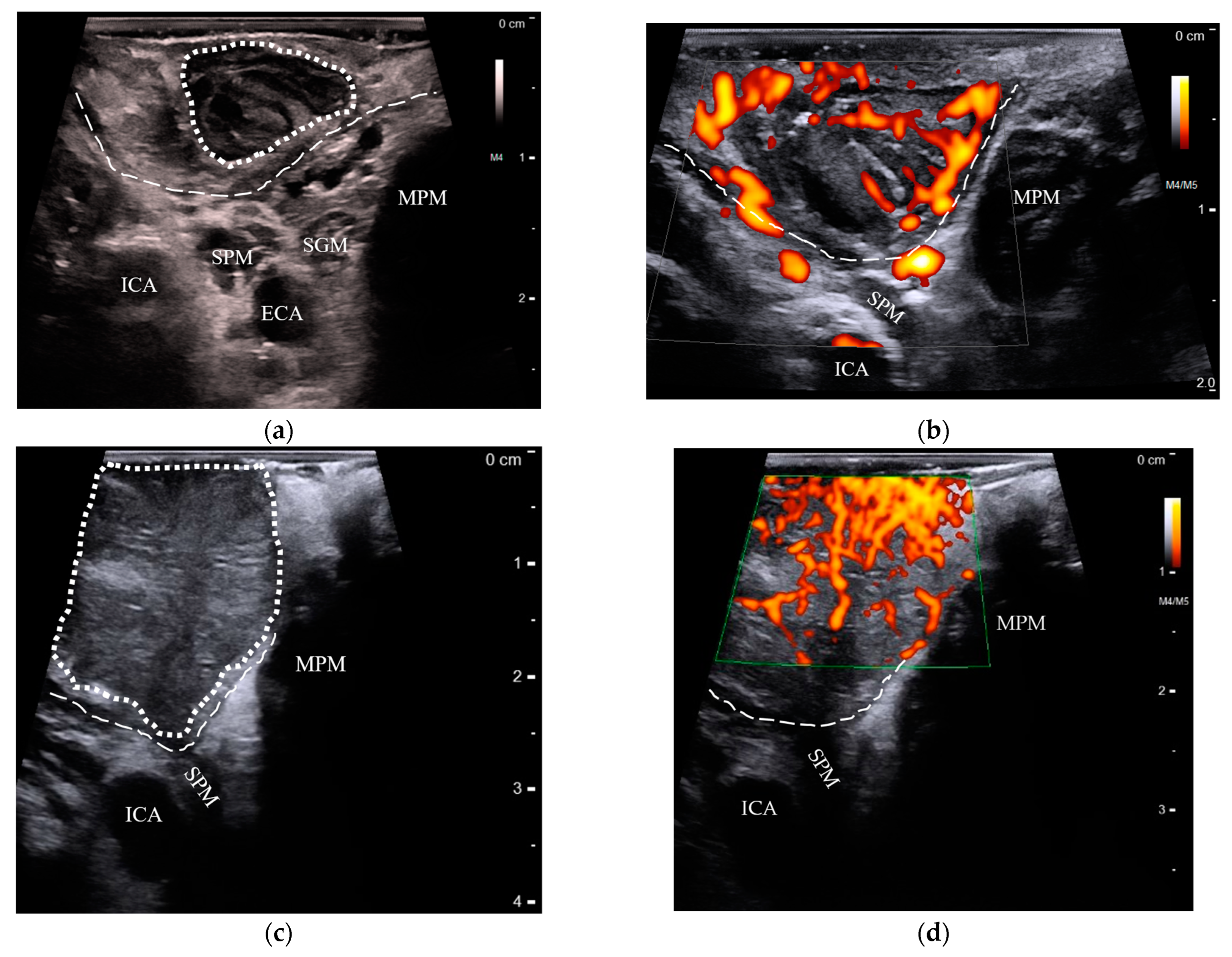 Cancers 15 05292 g002 Cancers 15 05292 g002