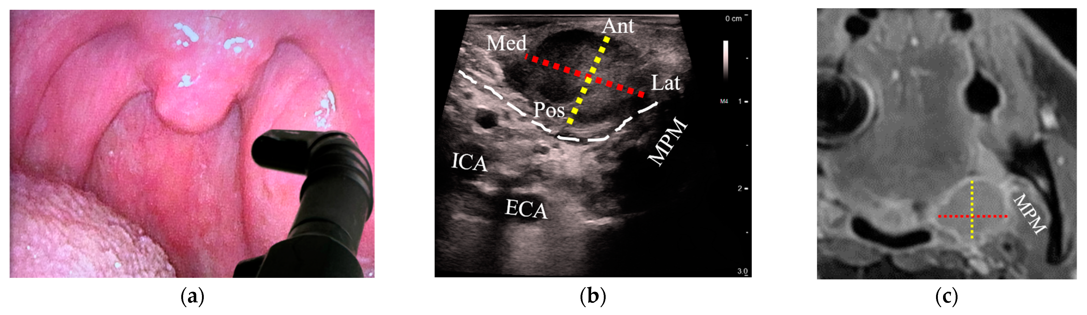 Cancers 15 05292 g004a Cancers 15 05292 g004a