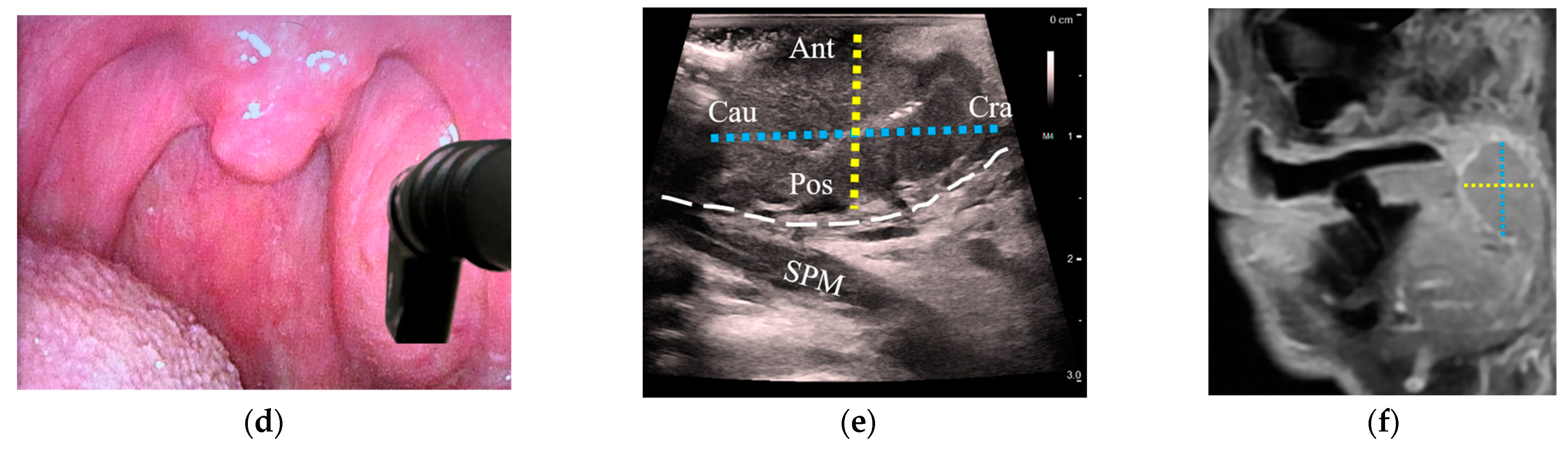 Cancers 15 05292 g004b Cancers 15 05292 g004b