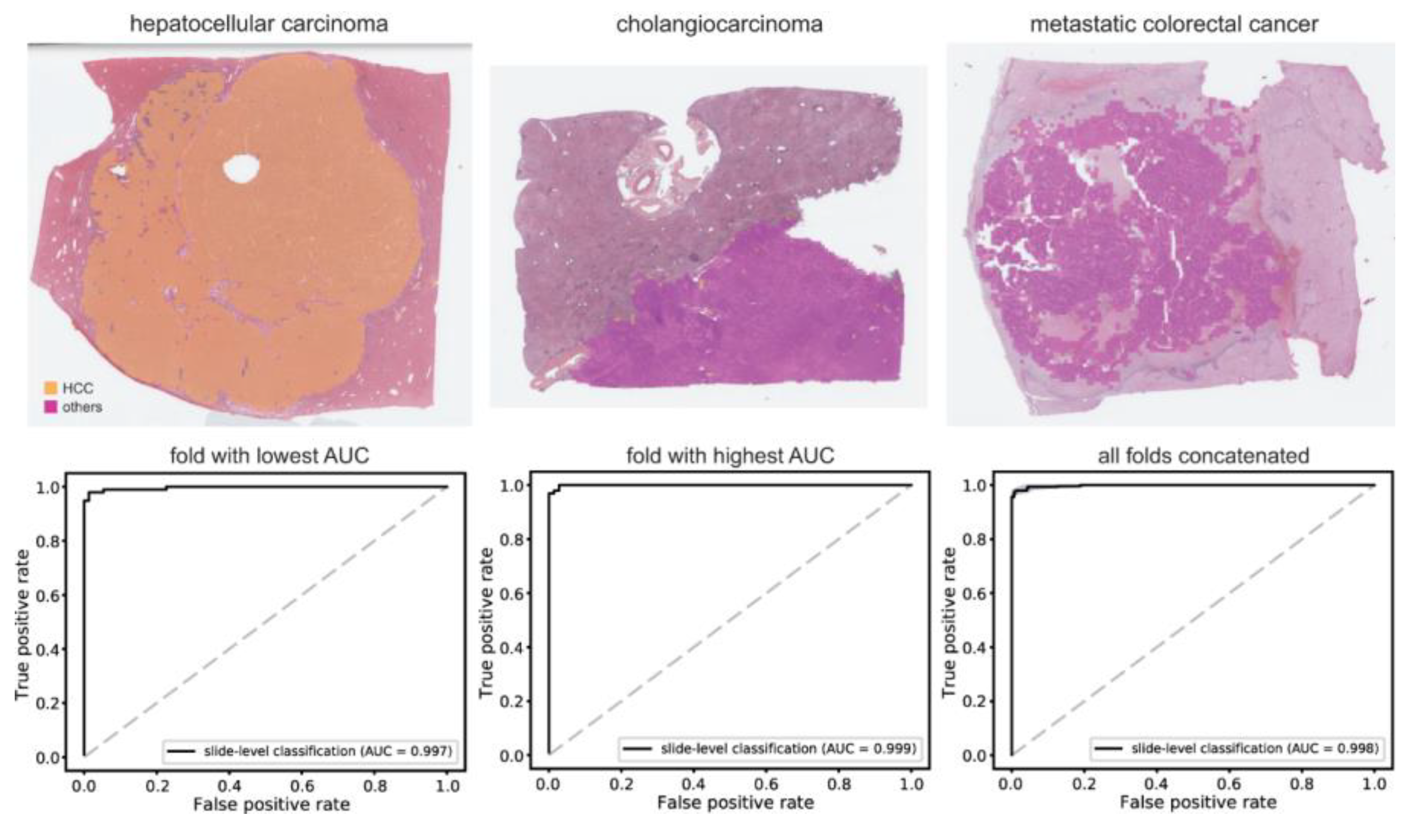 Cancers 15 05389 g003