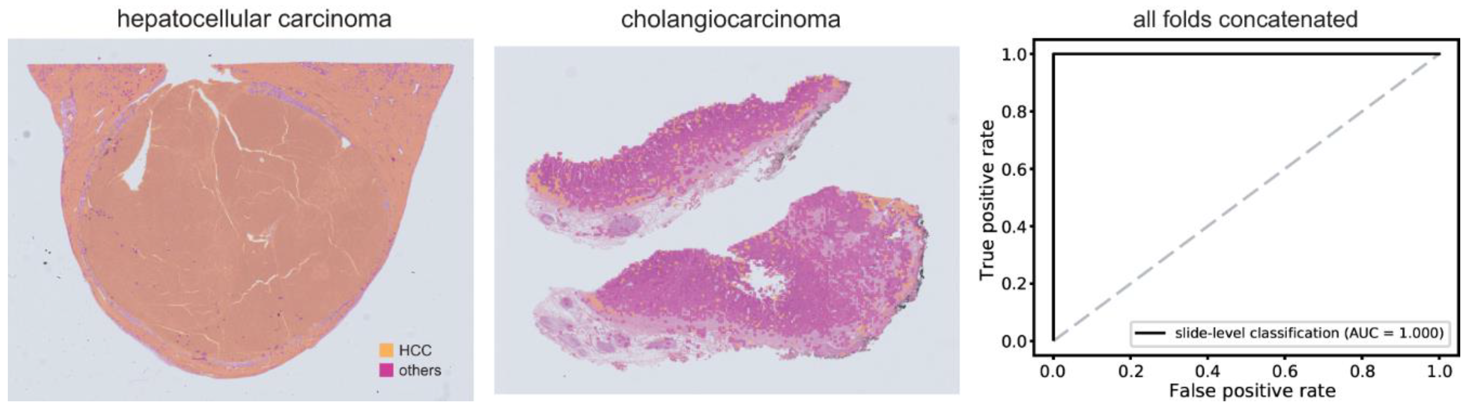 Cancers 15 05389 g005