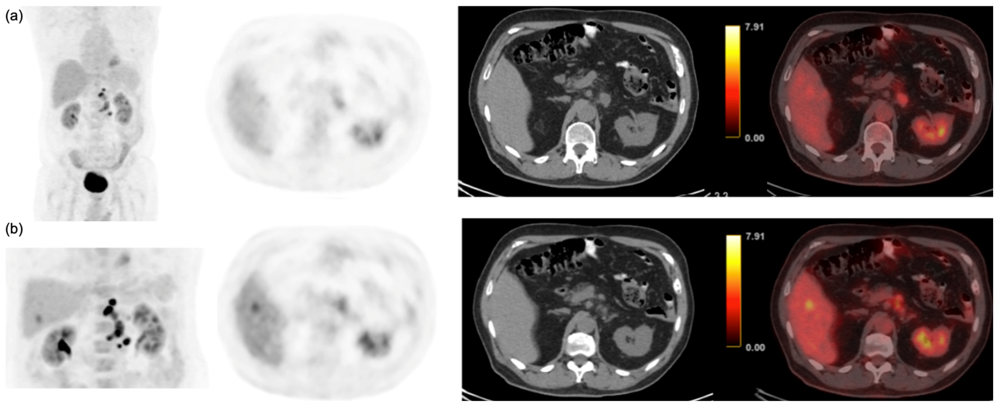 Cancers 15 05403 g001