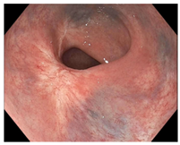 Cancers 15 05535 i001