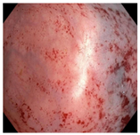 Cancers 15 05535 i003