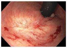 Cancers 15 05535 i005