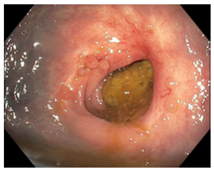 Cancers 15 05535 i007