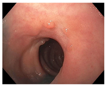 Cancers 15 05535 i009