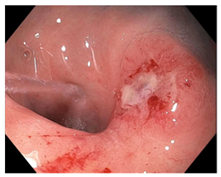 Cancers 15 05535 i010