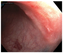 Cancers 15 05535 i015