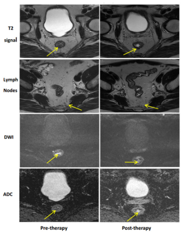 Cancers 15 05535 i016