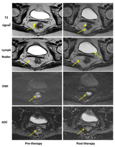 Cancers 15 05535 i017