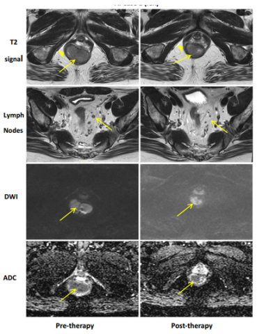 Cancers 15 05535 i018