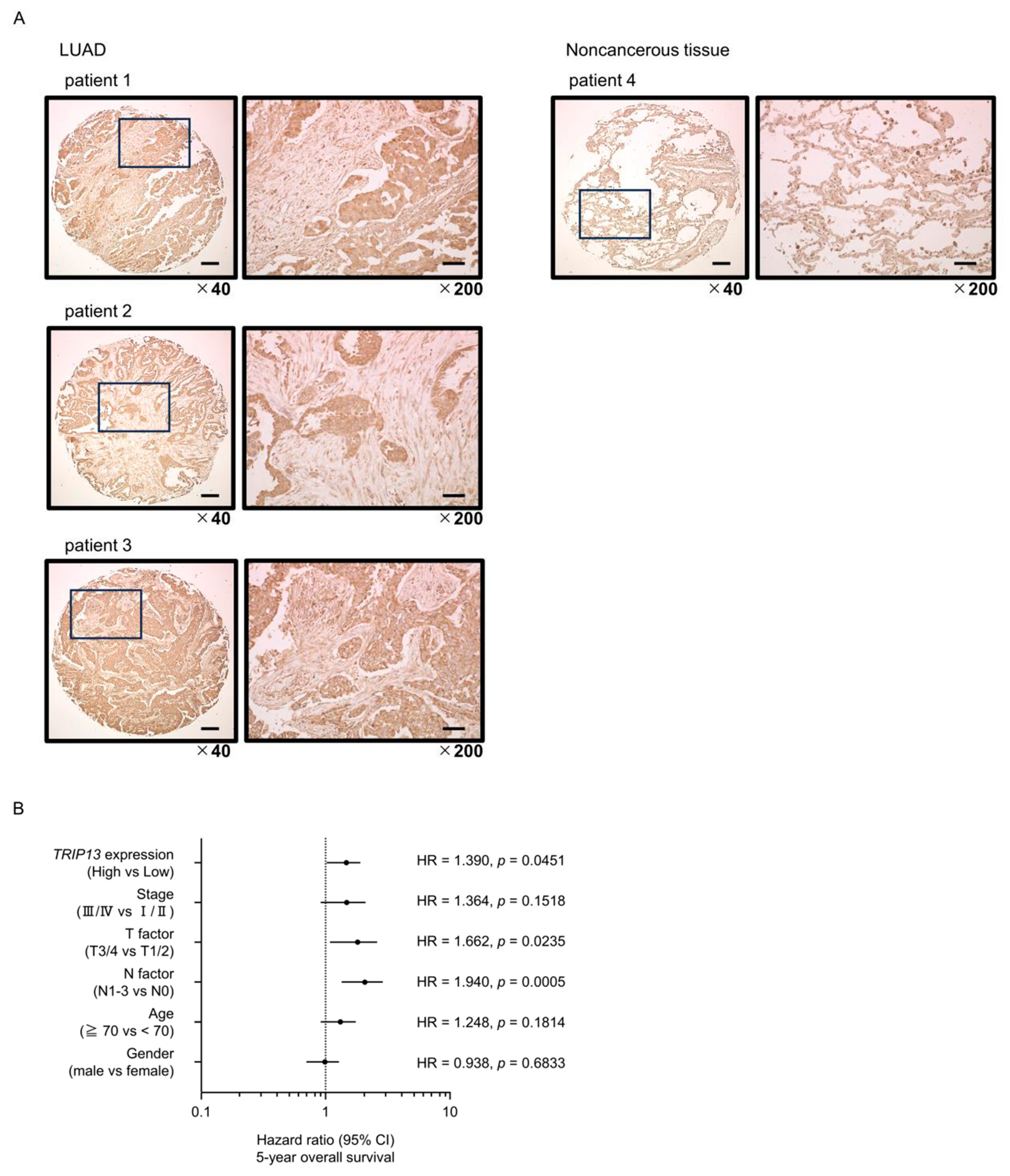 Cancers 15 05571 g007a Cancers 15 05571 g007a