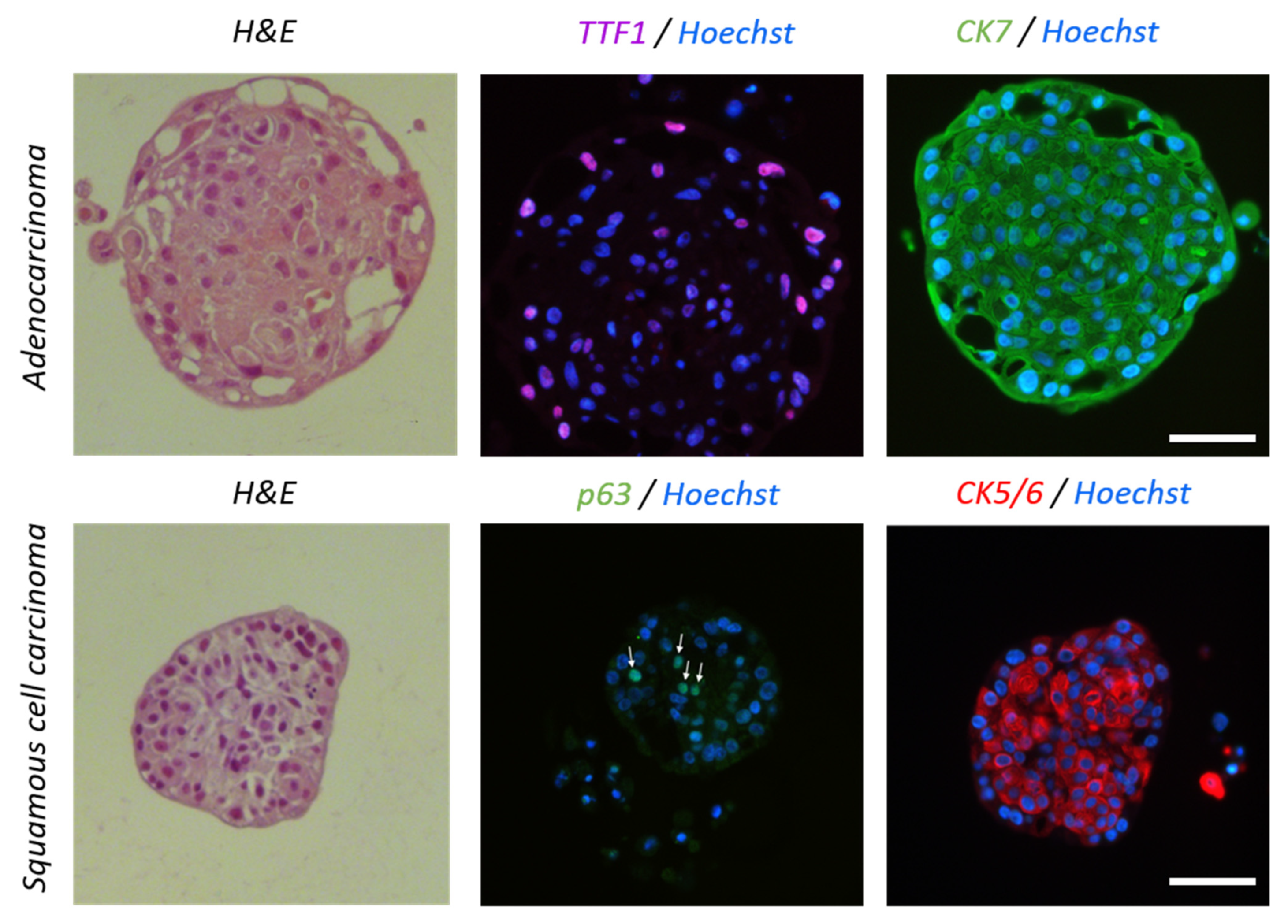 Cancers 15 05576 g004