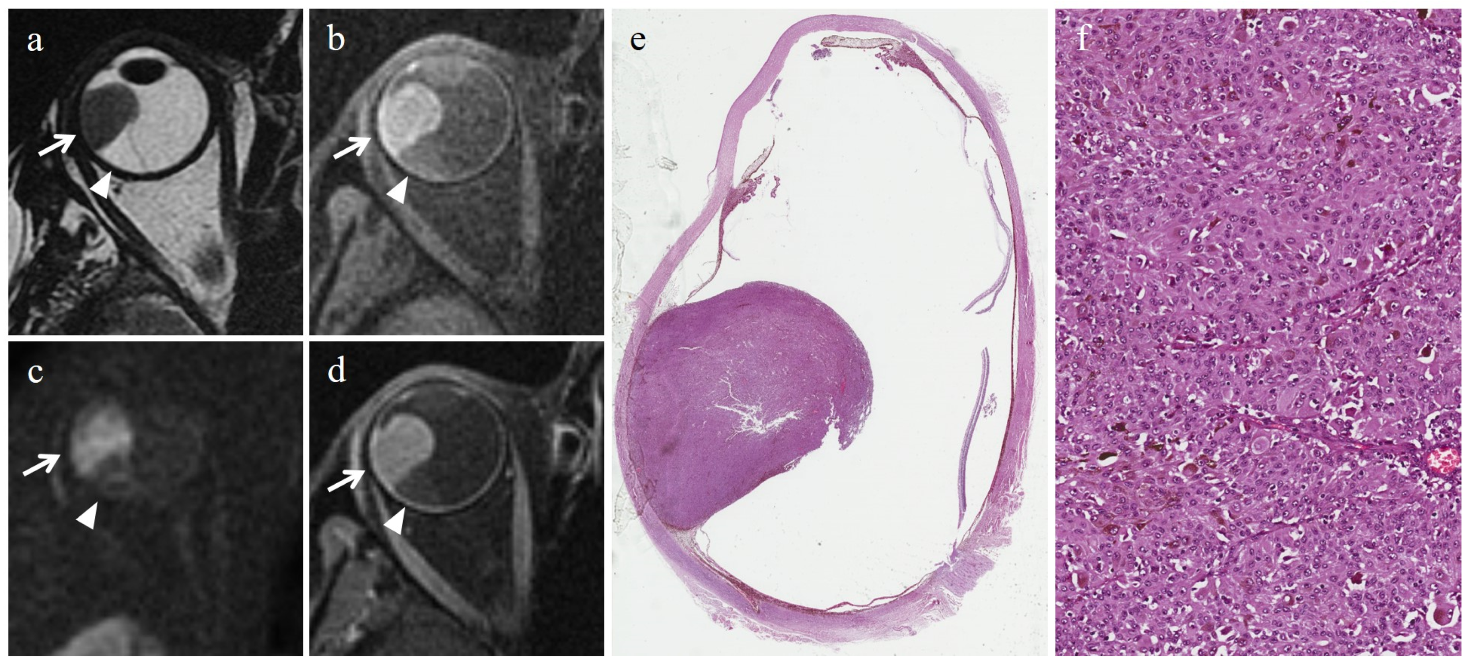Cancers 15 05627 g002 Cancers 15 05627 g002
