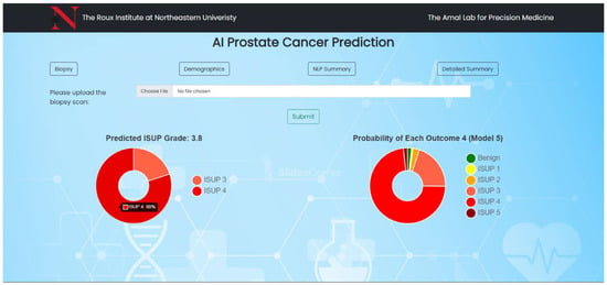 Tesla Tech Helps Detect Prostate Cancer