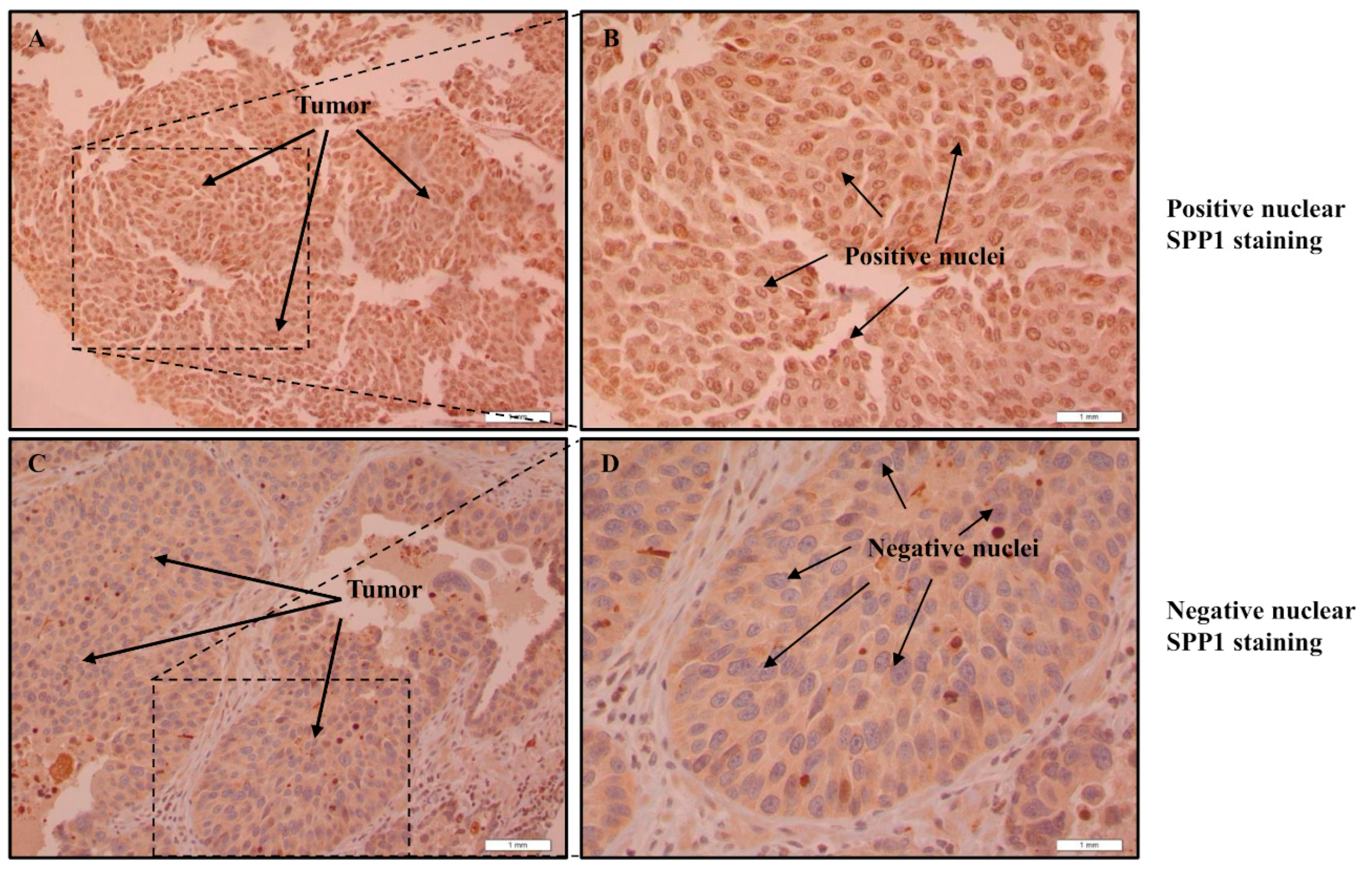 Cancers 15 05704 g004 Cancers 15 05704 g004