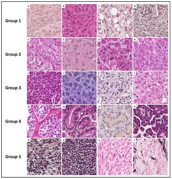 Relevance of Molecular Pathology for the Diagnosis of Sex  