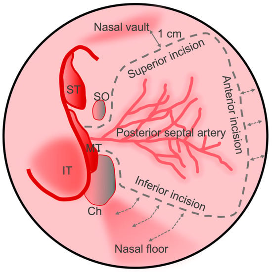 Cancers Free Full Text Reconstruction of the Anterior Skull