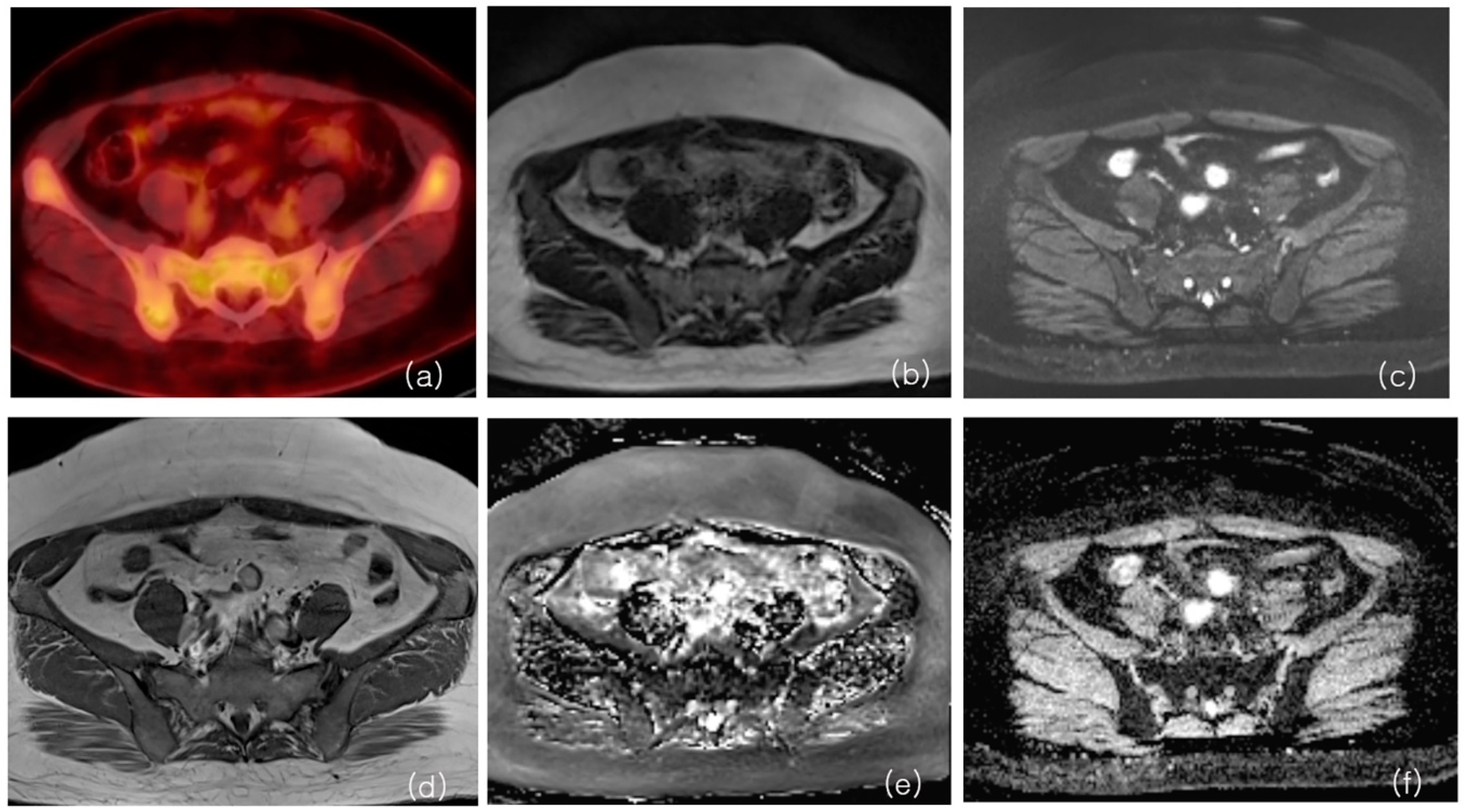 Cancers 16 00214 g003