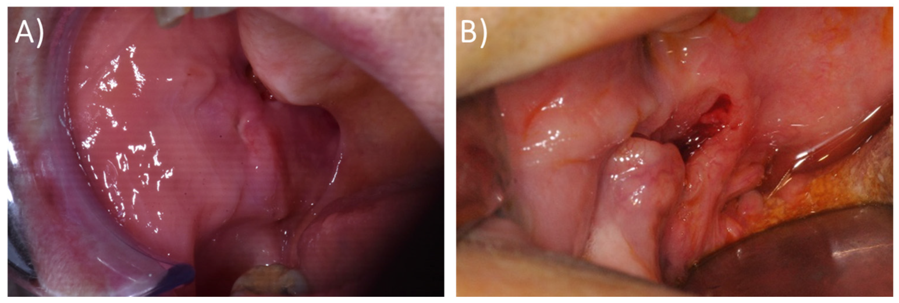 Cancers 16 00220 g002 Cancers 16 00220 g002