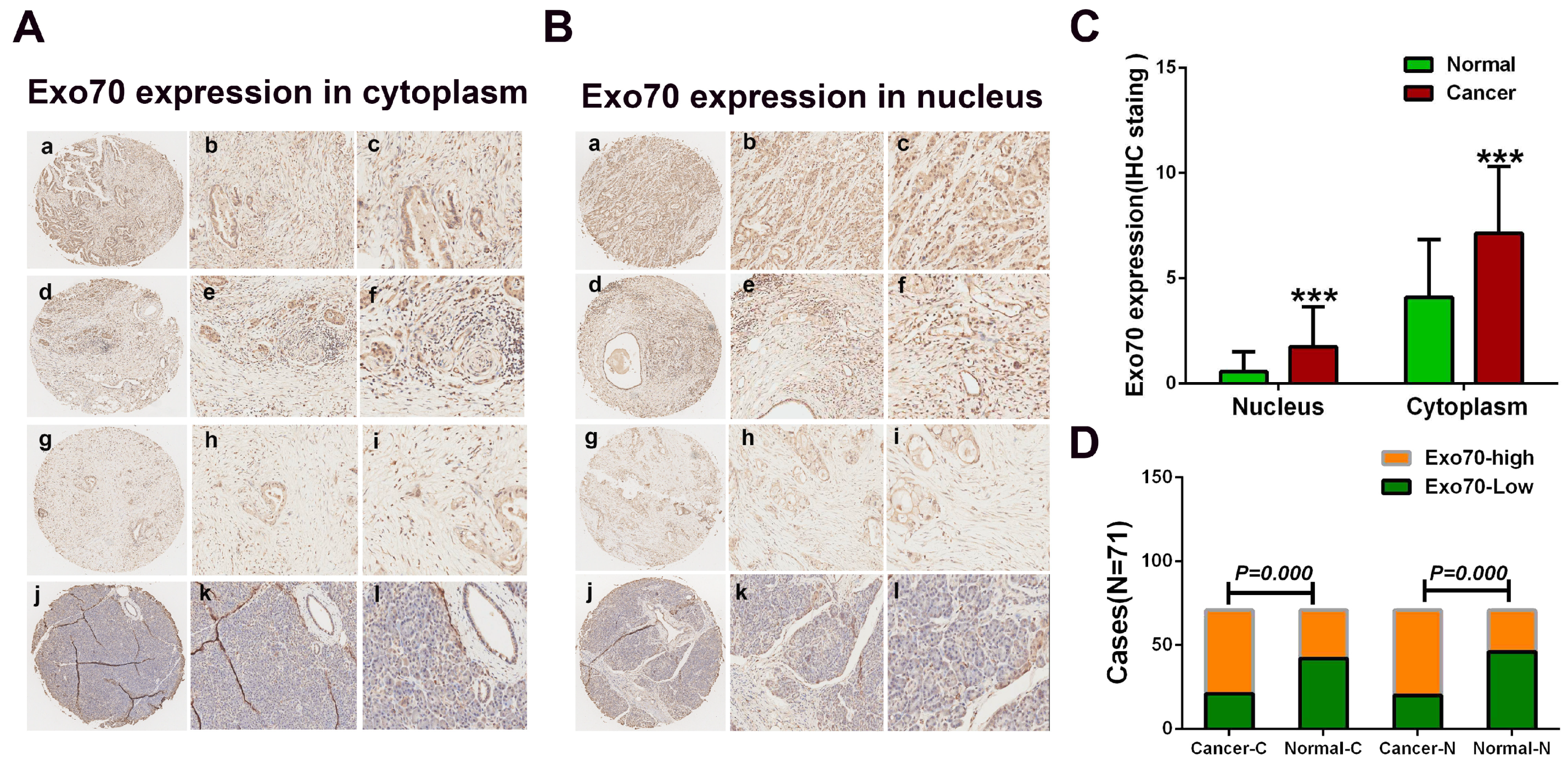 Cancers 16 00336 g001a