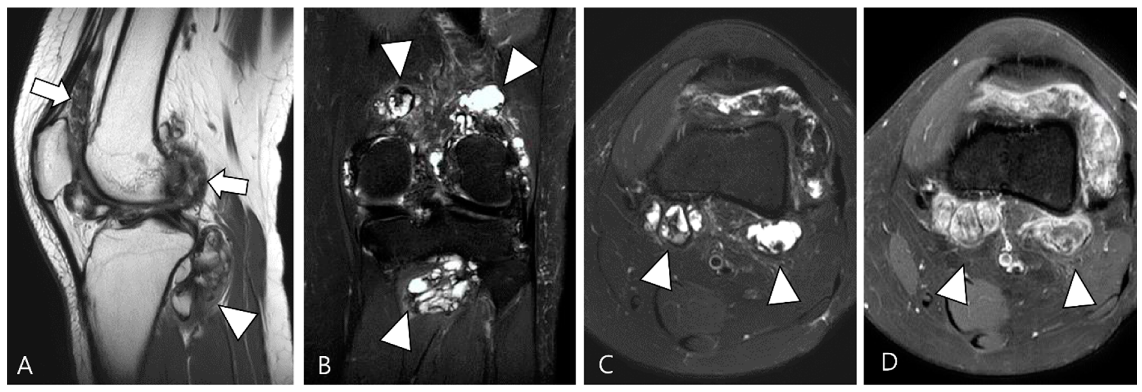 Cancers 16 00402 g003