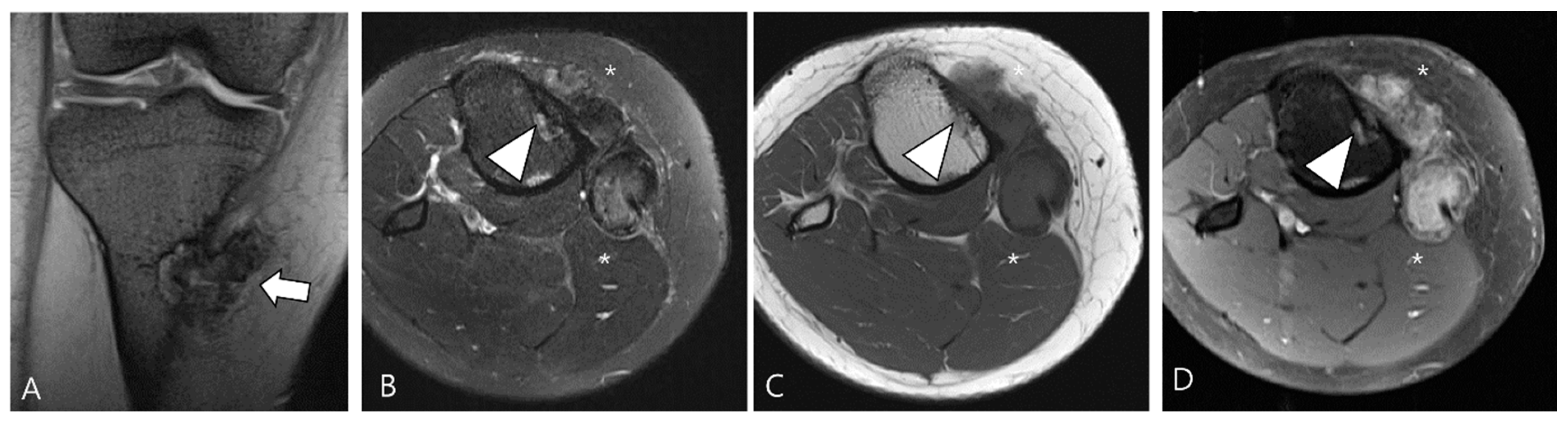 Cancers 16 00402 g004