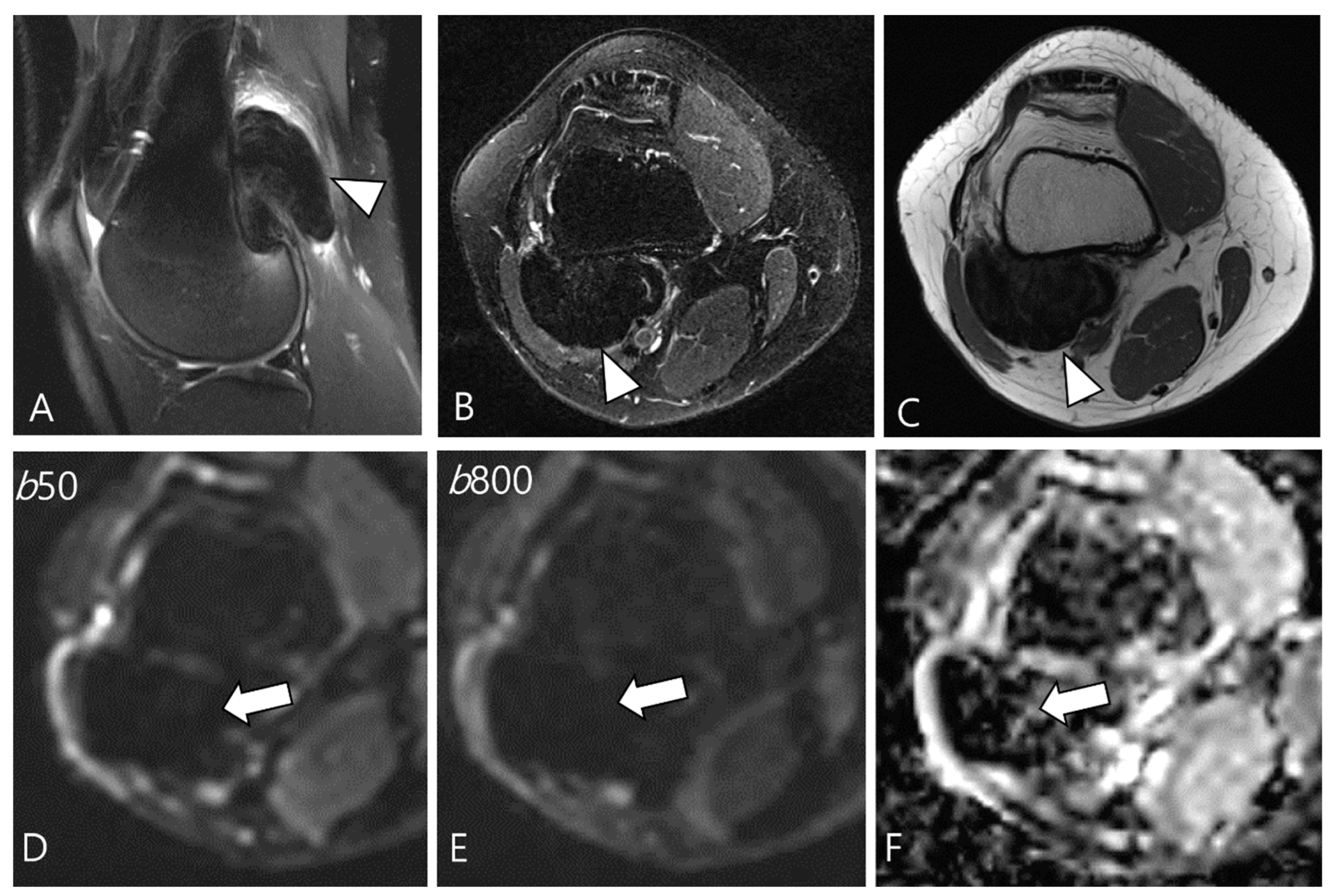 Cancers 16 00402 g007