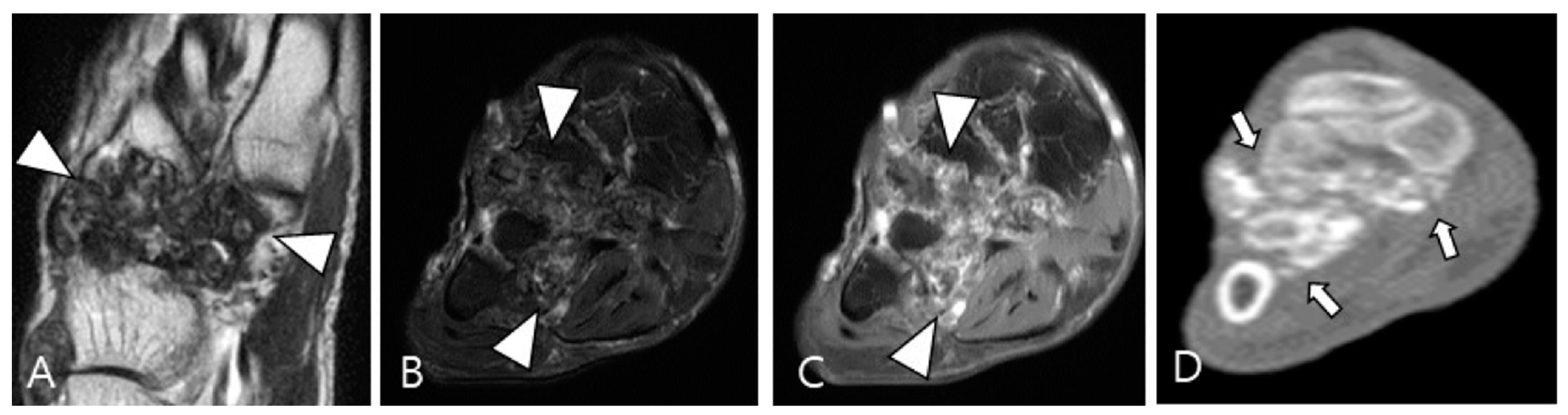 Cancers 16 00402 g011