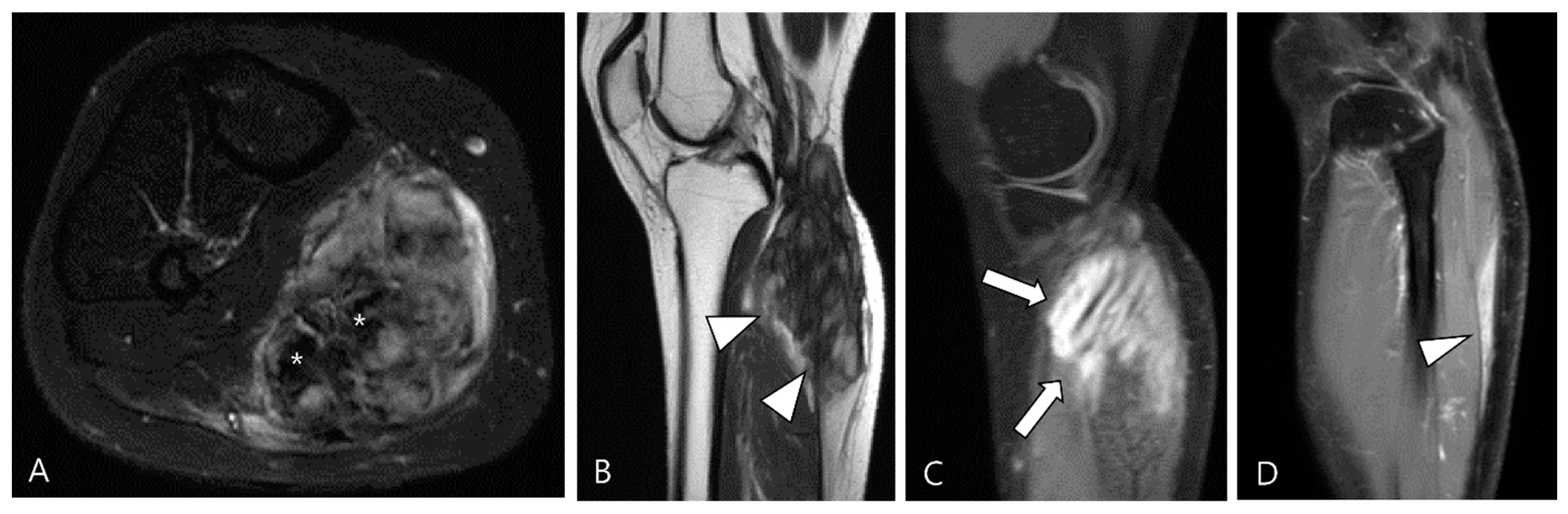 Cancers 16 00402 g016