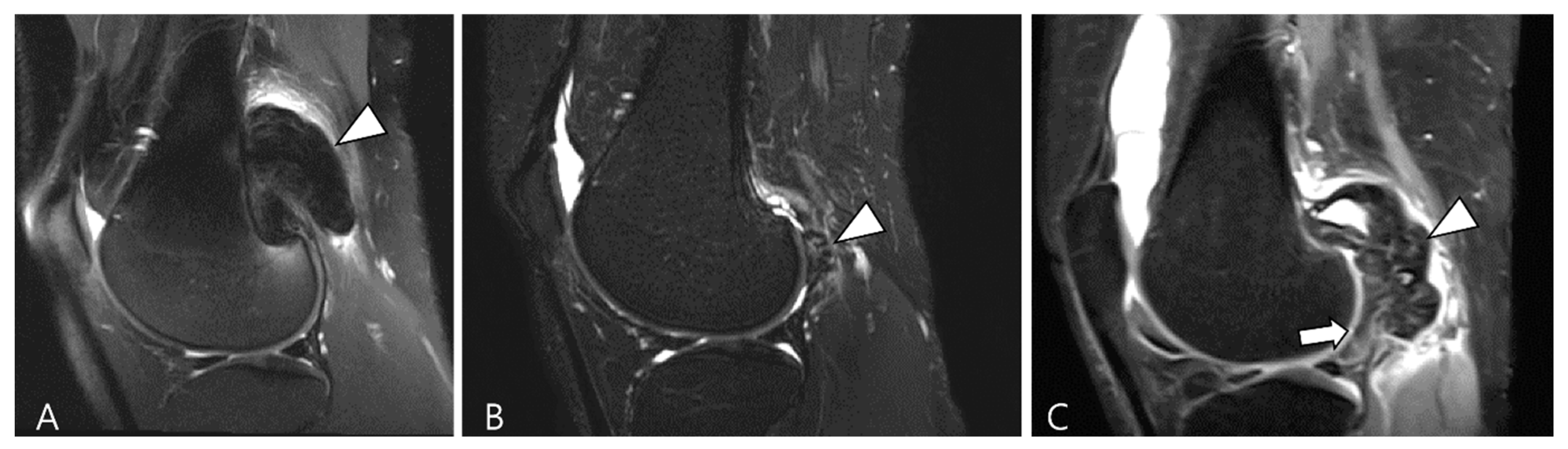 Cancers 16 00402 g018