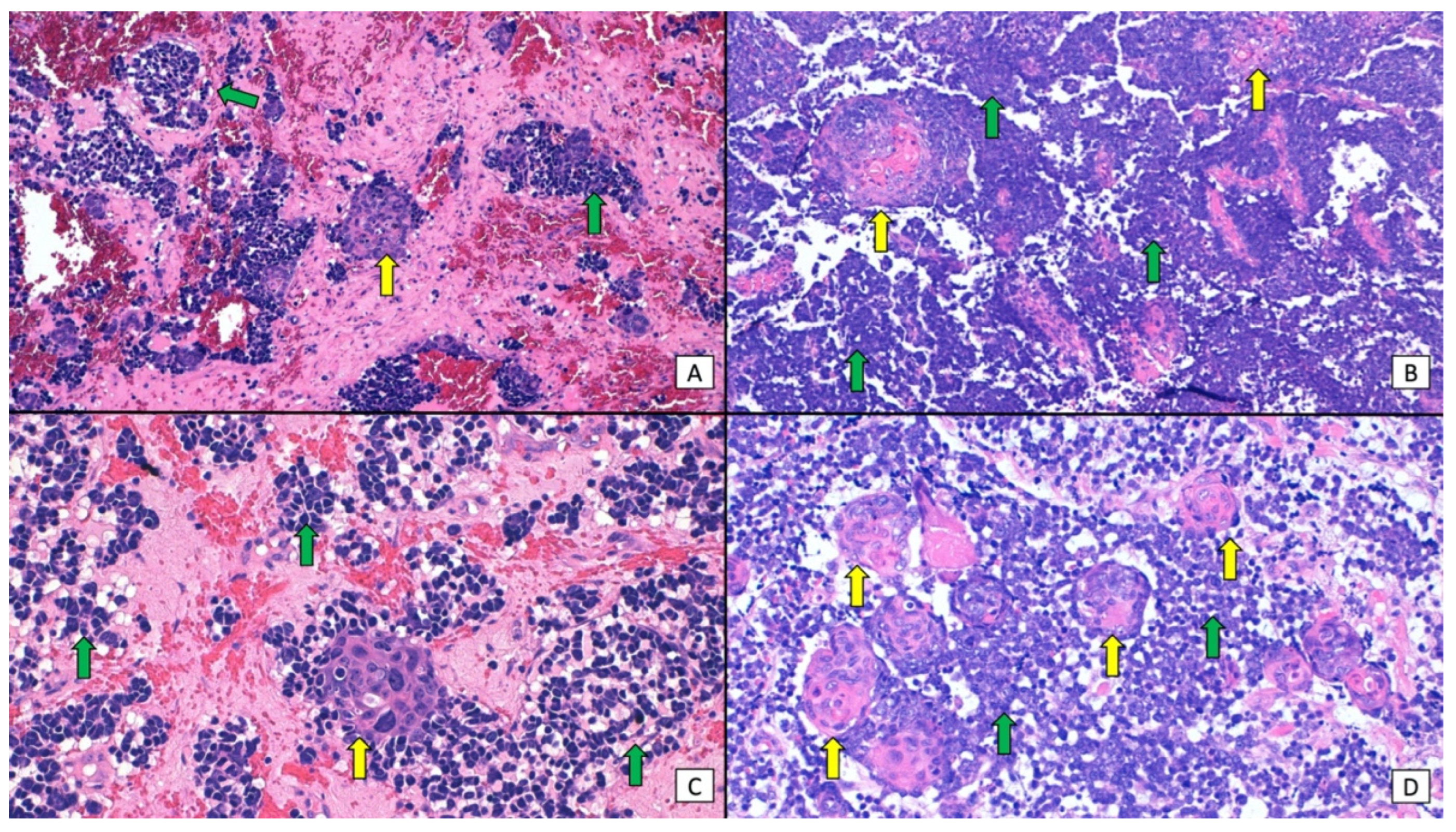 Cancers 16 00411 g003