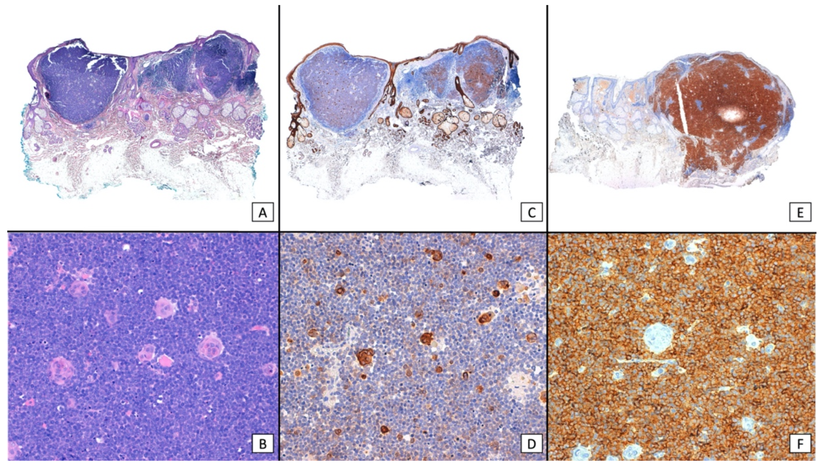 Cancers 16 00411 g004