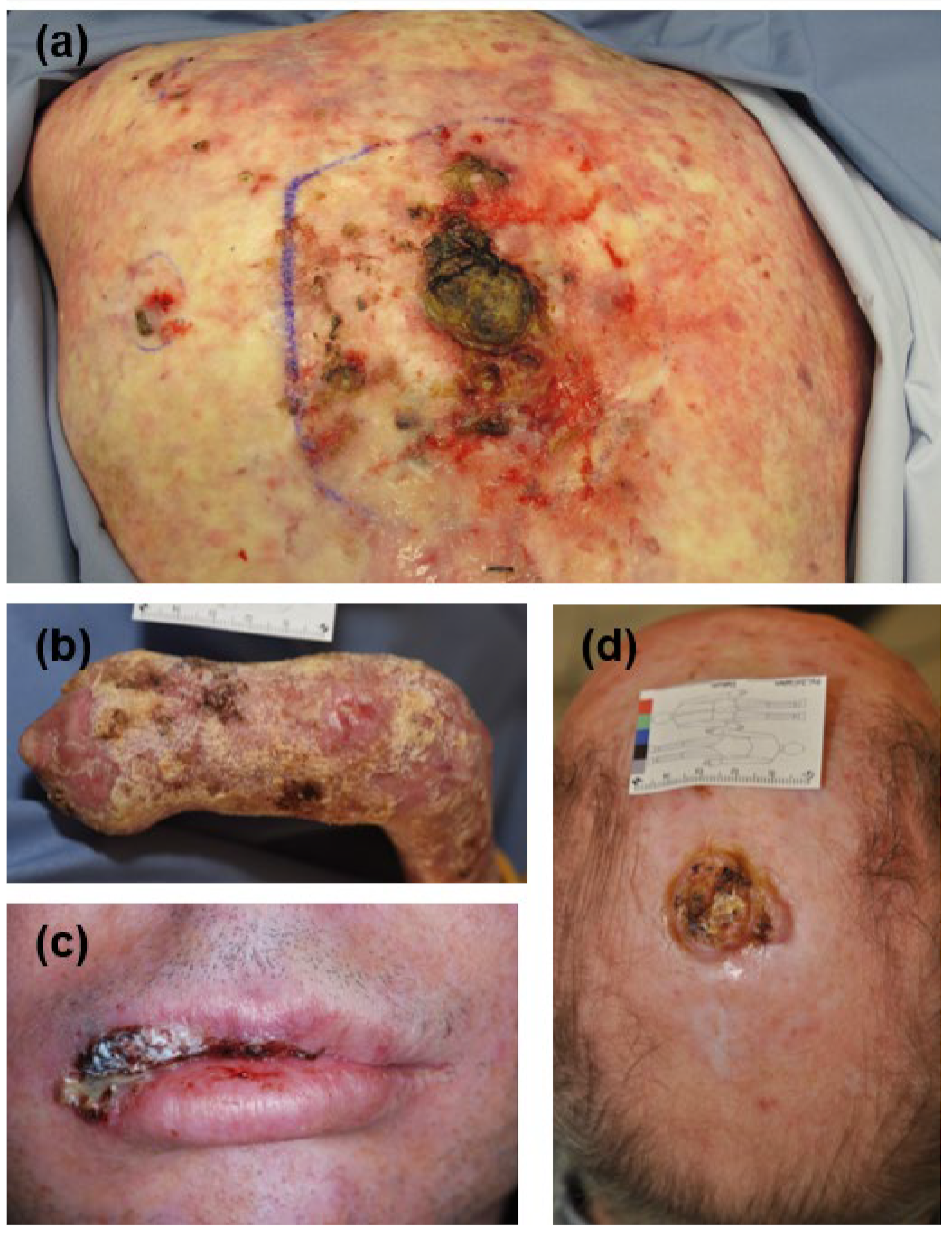 Cancers 16 00471 g001 Cancers 16 00471 g001