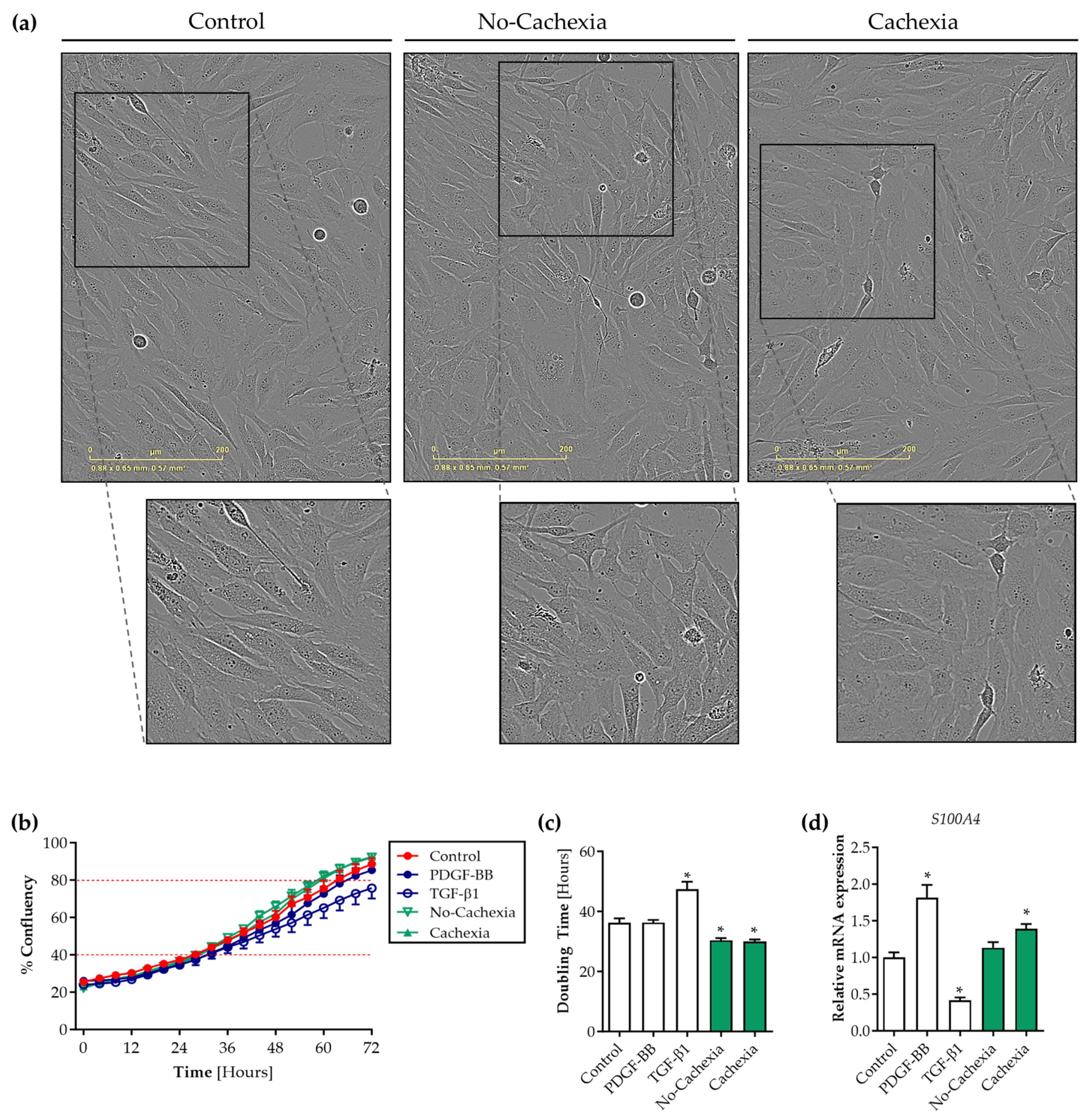 Cancers 16 00542 g004