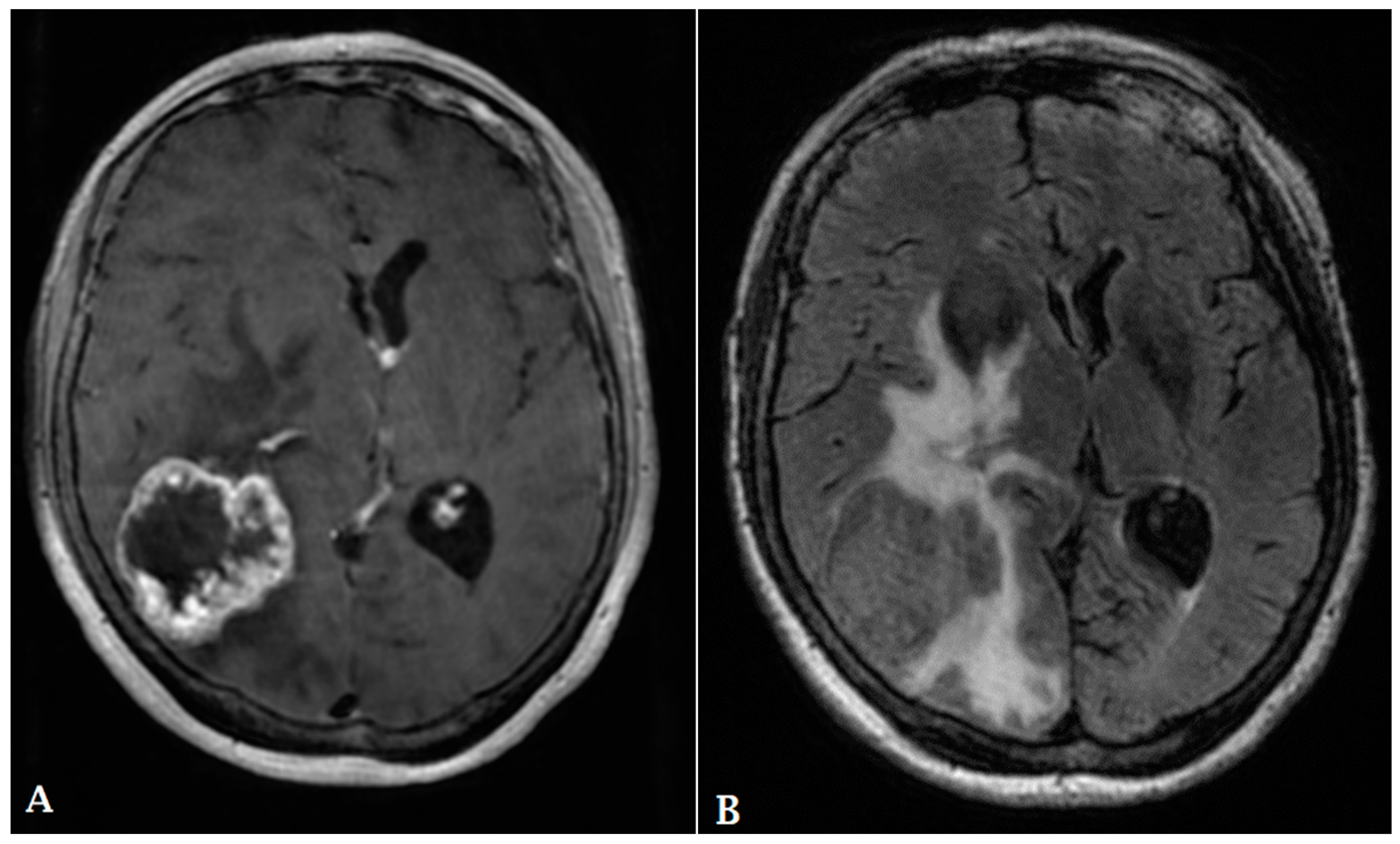 Cancers 16 00576 g005