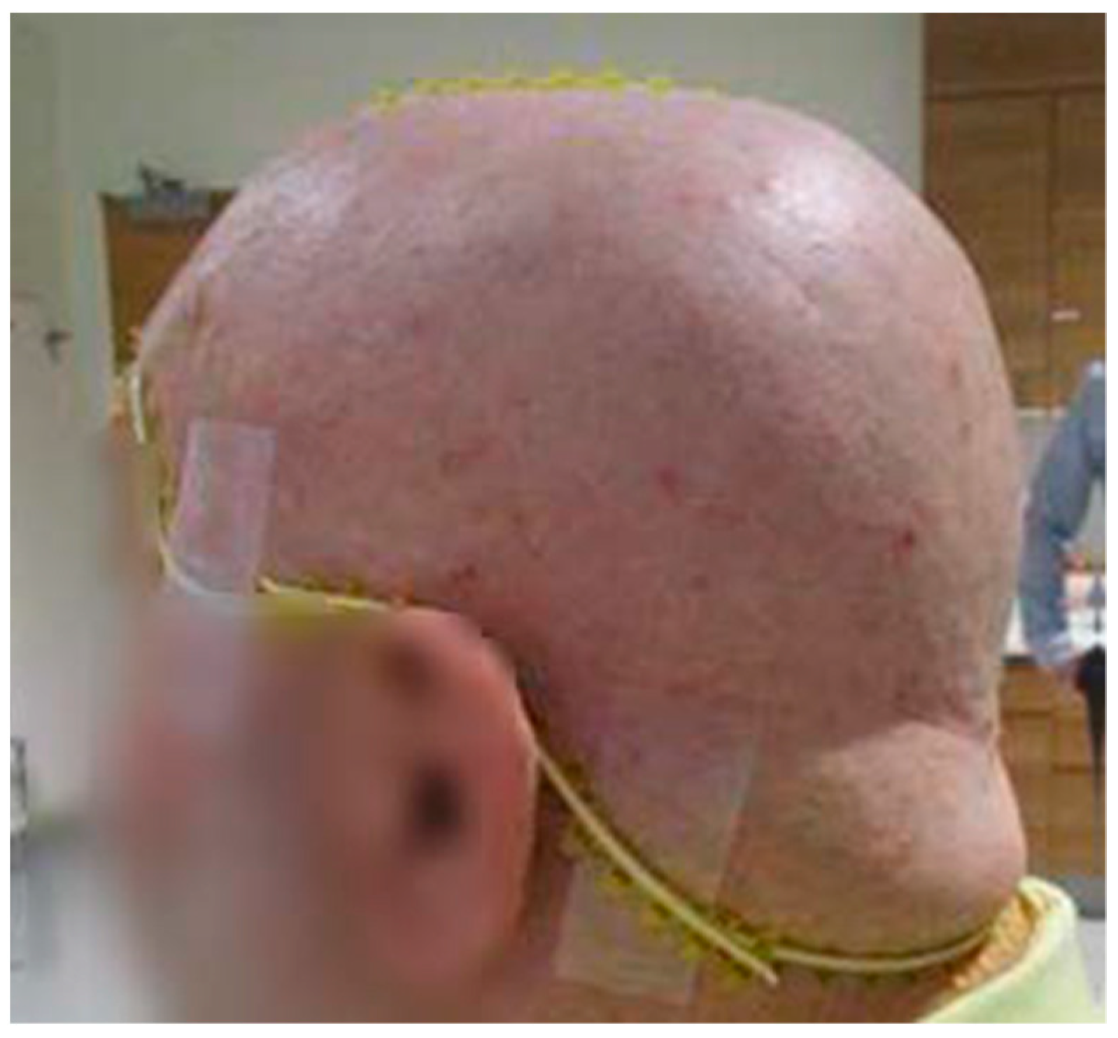 Cancers 16 00688 g002