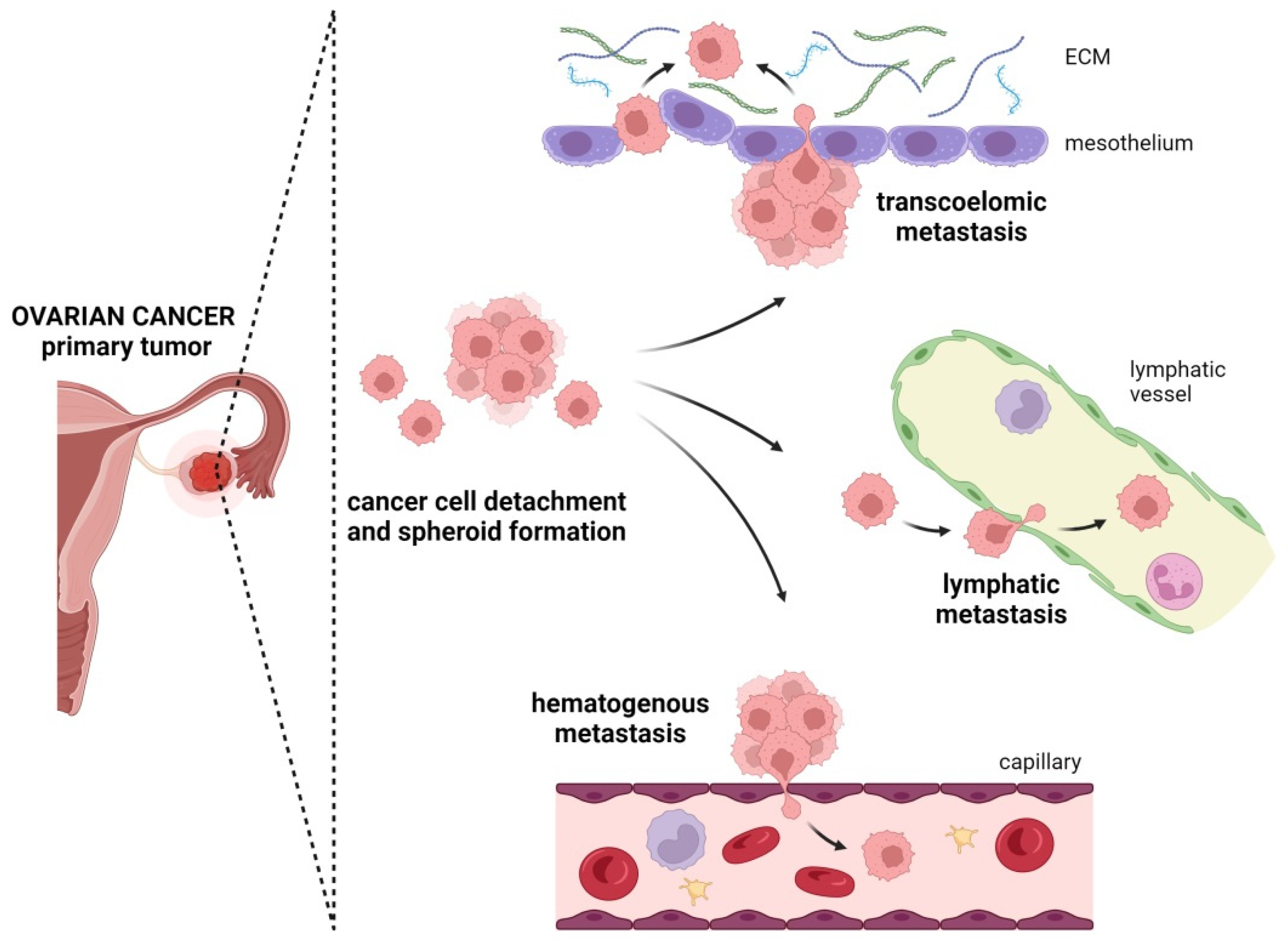 Cancers Free Full Text A Recipe For Successful Metastasis Transition And Migratory Modes Of 4233