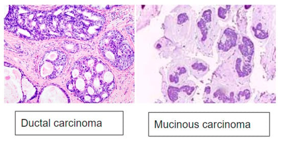 Cancers | Free Full-Text | Dielectric Characterization of Ex-Vivo ...